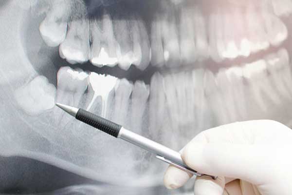 Oral Surgery Services